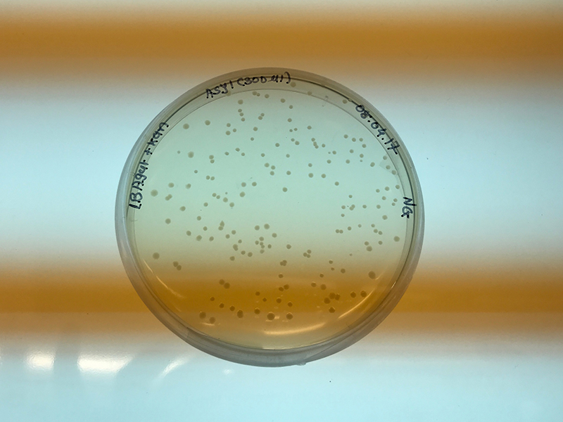 petri dish with bacteria growing